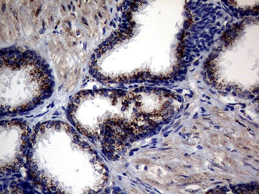 CTSL1 Antibody in Immunohistochemistry (Paraffin) (IHC (P))