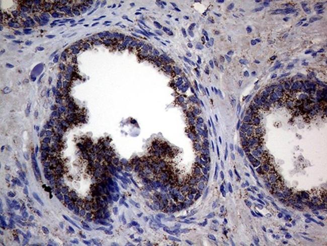 CTSL1 Antibody in Immunohistochemistry (Paraffin) (IHC (P))