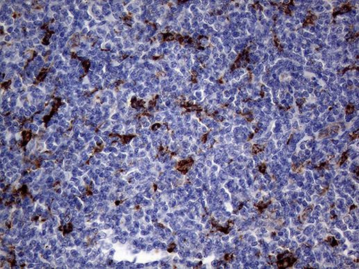 CTSL1 Antibody in Immunohistochemistry (Paraffin) (IHC (P))