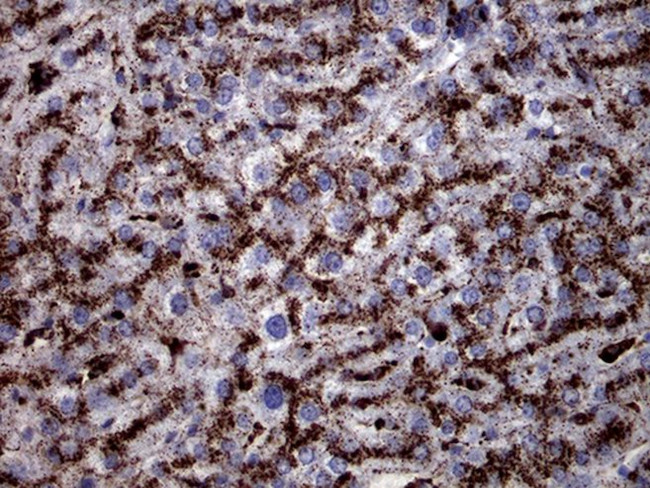 CTSL1 Antibody in Immunohistochemistry (Paraffin) (IHC (P))