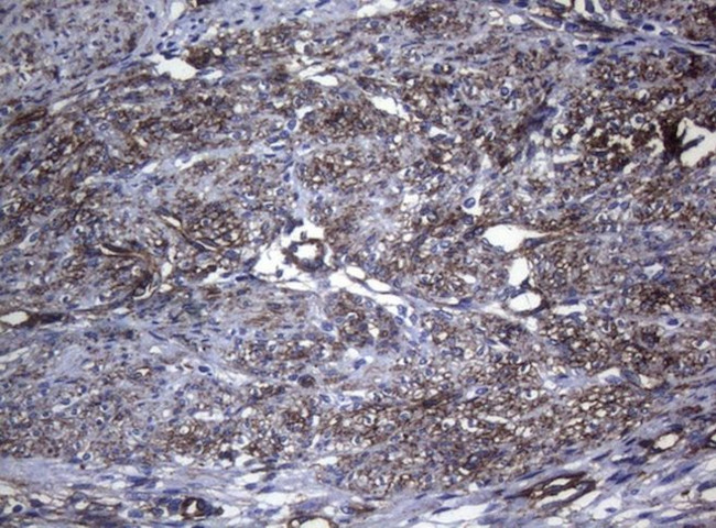 CTSL1 Antibody in Immunohistochemistry (Paraffin) (IHC (P))