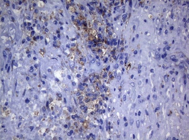 CTSL1 Antibody in Immunohistochemistry (Paraffin) (IHC (P))