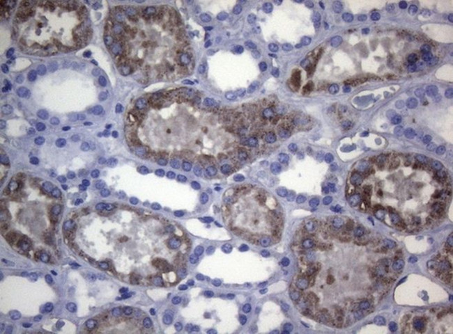 CTSL1 Antibody in Immunohistochemistry (Paraffin) (IHC (P))