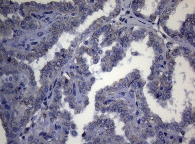 CTSL1 Antibody in Immunohistochemistry (Paraffin) (IHC (P))