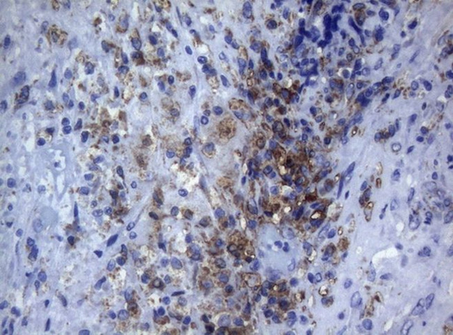 CTSL1 Antibody in Immunohistochemistry (Paraffin) (IHC (P))