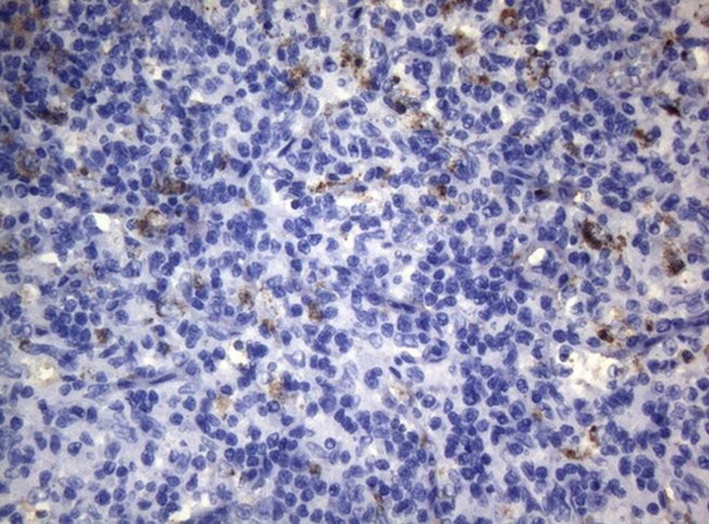 CTSL1 Antibody in Immunohistochemistry (Paraffin) (IHC (P))