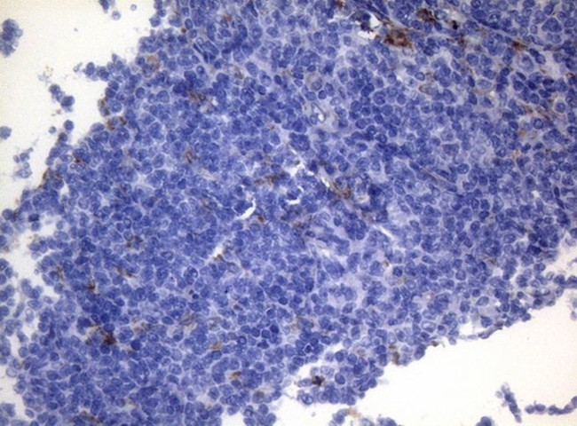 CTSL1 Antibody in Immunohistochemistry (Paraffin) (IHC (P))