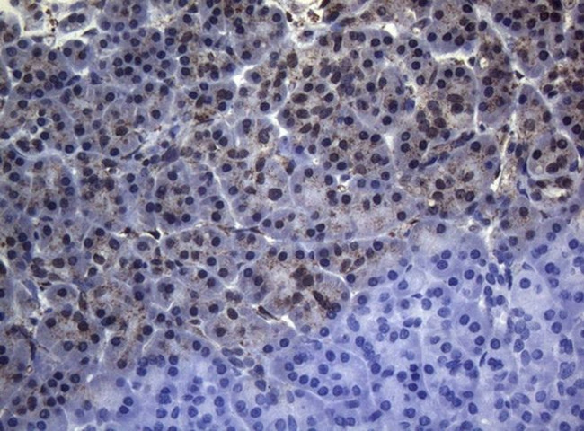 CTSL1 Antibody in Immunohistochemistry (Paraffin) (IHC (P))