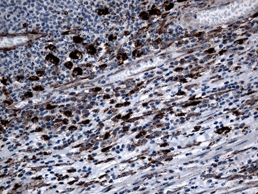 CTSL1 Antibody in Immunohistochemistry (Paraffin) (IHC (P))