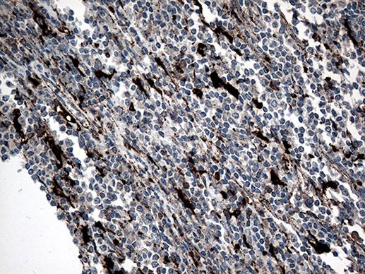 CTSL1 Antibody in Immunohistochemistry (Paraffin) (IHC (P))