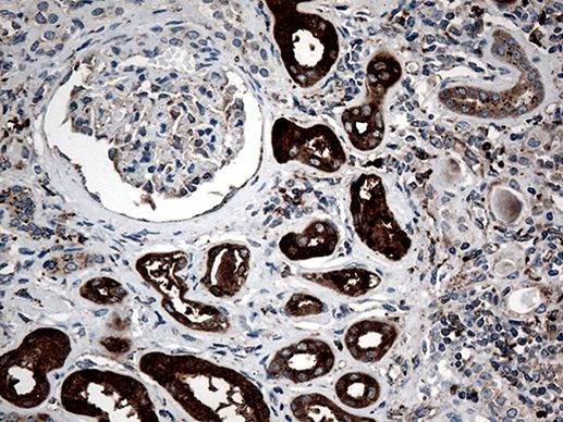 CTSL1 Antibody in Immunohistochemistry (Paraffin) (IHC (P))