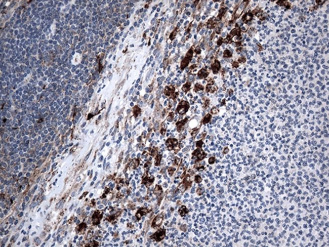 CTSL1 Antibody in Immunohistochemistry (Paraffin) (IHC (P))