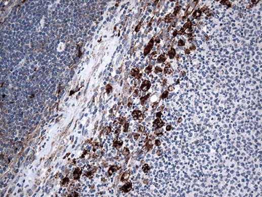 CTSL1 Antibody in Immunohistochemistry (Paraffin) (IHC (P))