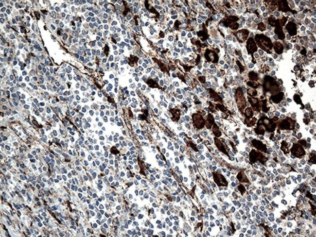 CTSL1 Antibody in Immunohistochemistry (Paraffin) (IHC (P))