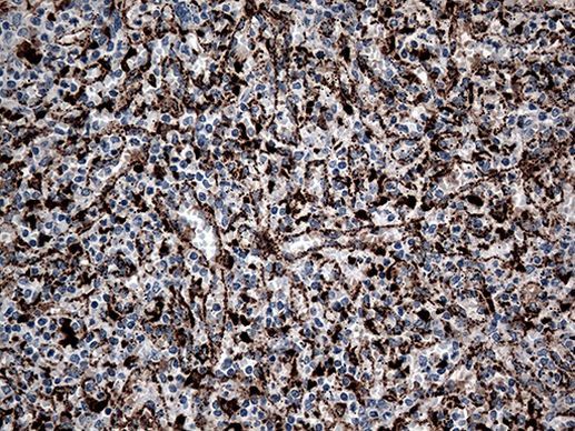 CTSL1 Antibody in Immunohistochemistry (Paraffin) (IHC (P))