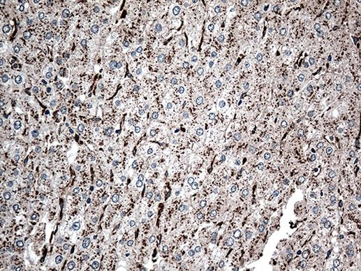 CTSL1 Antibody in Immunohistochemistry (Paraffin) (IHC (P))