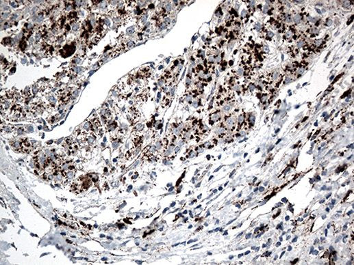 CTSL1 Antibody in Immunohistochemistry (Paraffin) (IHC (P))