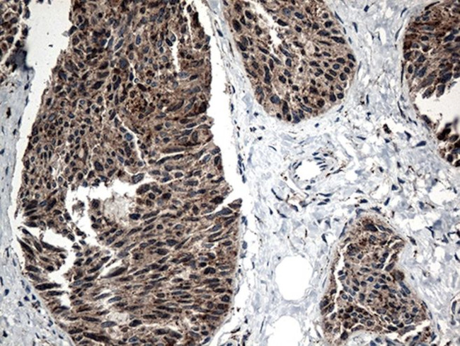 CTSL1 Antibody in Immunohistochemistry (Paraffin) (IHC (P))