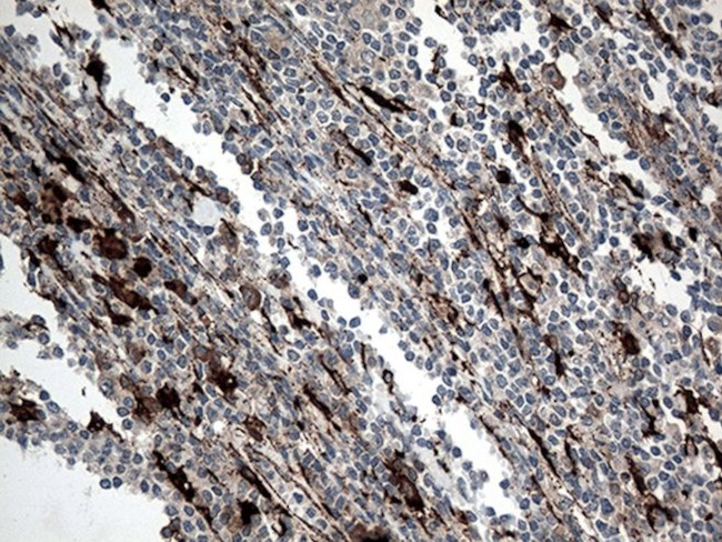 CTSL1 Antibody in Immunohistochemistry (Paraffin) (IHC (P))