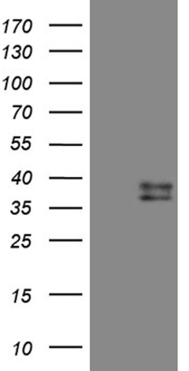 CTSL1 Antibody in Western Blot (WB)