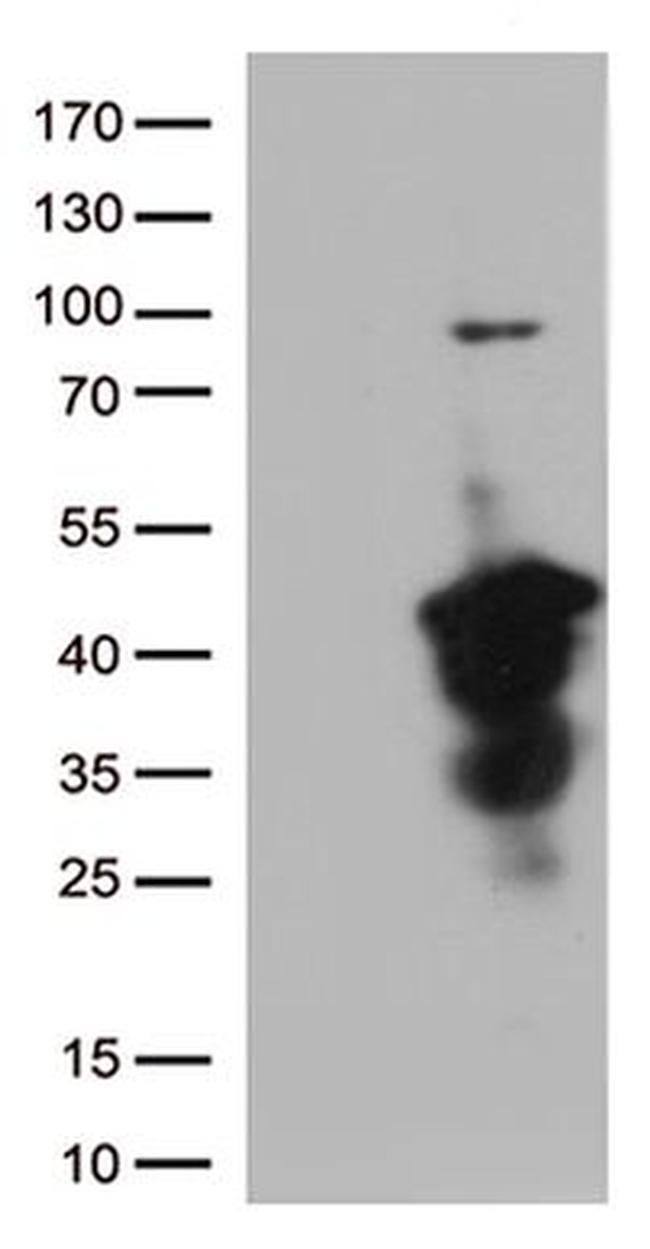 CTSL1 Antibody in Western Blot (WB)