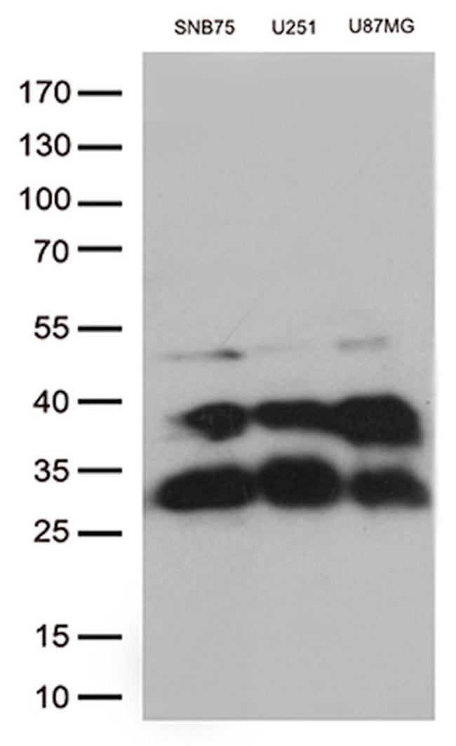 CTSL1 Antibody in Western Blot (WB)