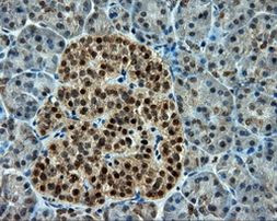 CUGBP1 Antibody in Immunohistochemistry (Paraffin) (IHC (P))