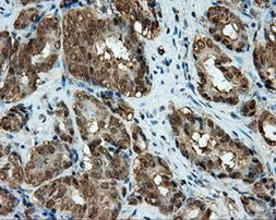 CUGBP1 Antibody in Immunohistochemistry (Paraffin) (IHC (P))