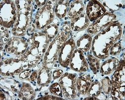 CUGBP1 Antibody in Immunohistochemistry (Paraffin) (IHC (P))