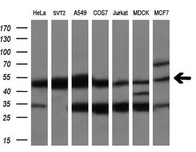 CUGBP1 Antibody in Western Blot (WB)