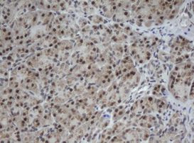 CUL4B Antibody in Immunohistochemistry (Paraffin) (IHC (P))