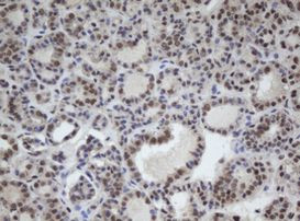 CUL4B Antibody in Immunohistochemistry (Paraffin) (IHC (P))