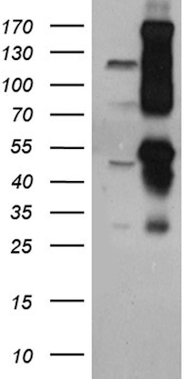 CUX1/Protein CASP Antibody in Western Blot (WB)