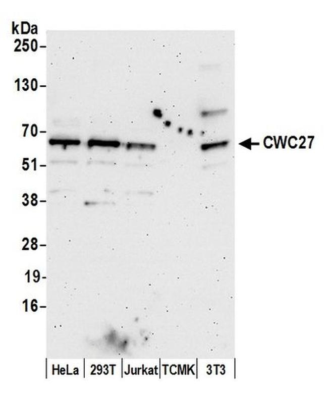 CWC27 Antibody in Western Blot (WB)