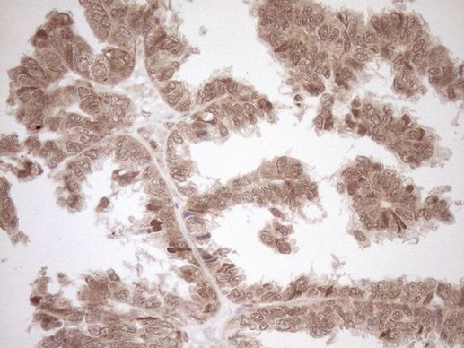 CWC27 Antibody in Immunohistochemistry (Paraffin) (IHC (P))