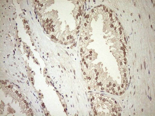 CWC27 Antibody in Immunohistochemistry (Paraffin) (IHC (P))