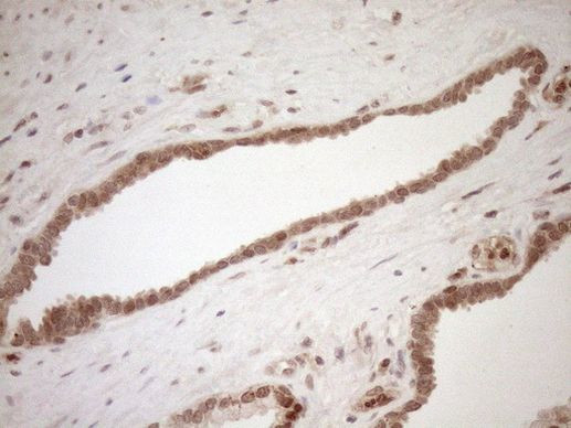 CWC27 Antibody in Immunohistochemistry (Paraffin) (IHC (P))