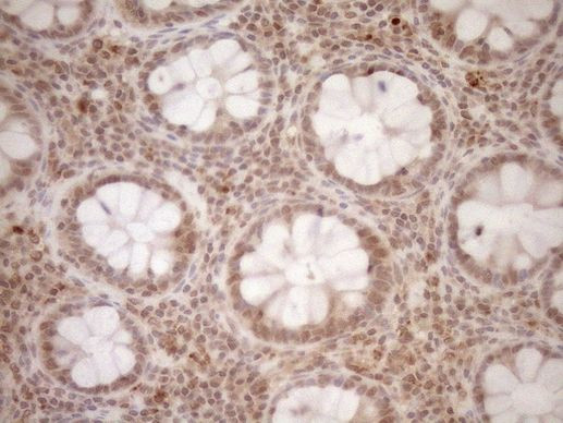 CWC27 Antibody in Immunohistochemistry (Paraffin) (IHC (P))