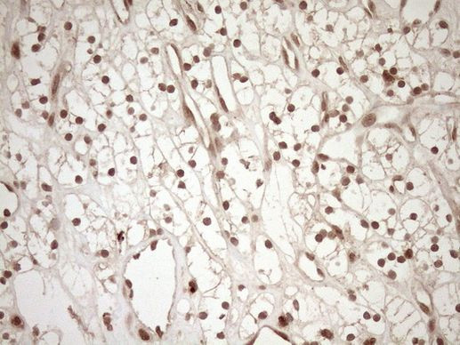 CWC27 Antibody in Immunohistochemistry (Paraffin) (IHC (P))