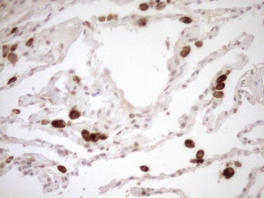 CWC27 Antibody in Immunohistochemistry (Paraffin) (IHC (P))