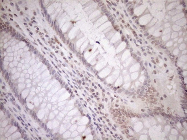 CWC27 Antibody in Immunohistochemistry (Paraffin) (IHC (P))