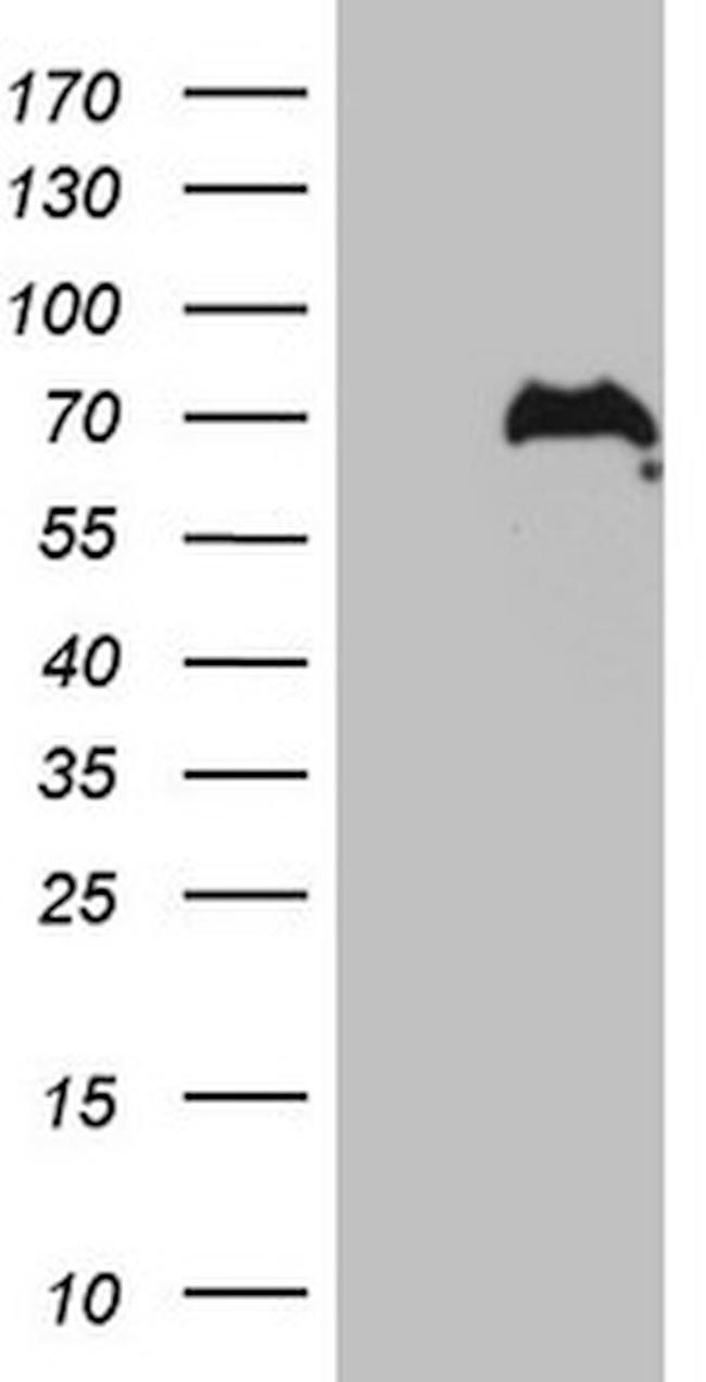 CWC27 Antibody in Western Blot (WB)