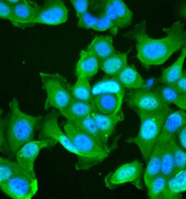 CXCR1 Antibody in Immunocytochemistry (ICC/IF)