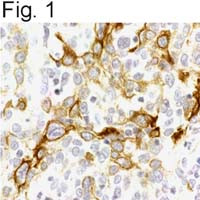 CXCR4 Antibody in Immunohistochemistry (IHC)