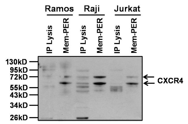 CXCR4 Antibody in Western Blot (WB)