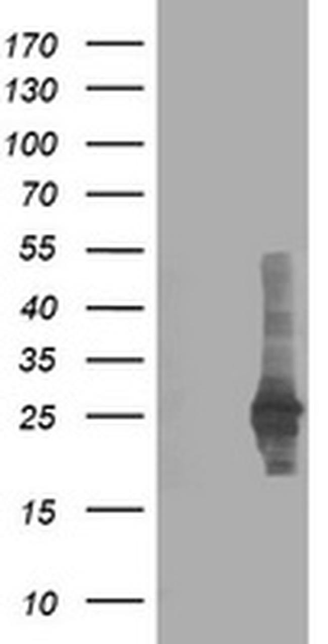 CXorf26 Antibody in Western Blot (WB)