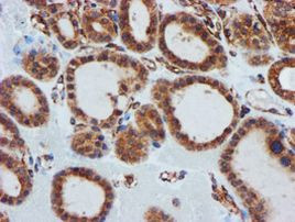 CYB5R3 Antibody in Immunohistochemistry (Paraffin) (IHC (P))