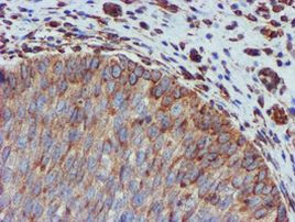 CYB5R3 Antibody in Immunohistochemistry (Paraffin) (IHC (P))