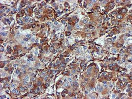 CYB5R3 Antibody in Immunohistochemistry (Paraffin) (IHC (P))