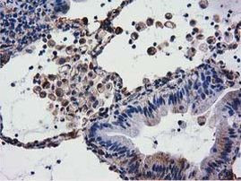 CYB5R3 Antibody in Immunohistochemistry (Paraffin) (IHC (P))